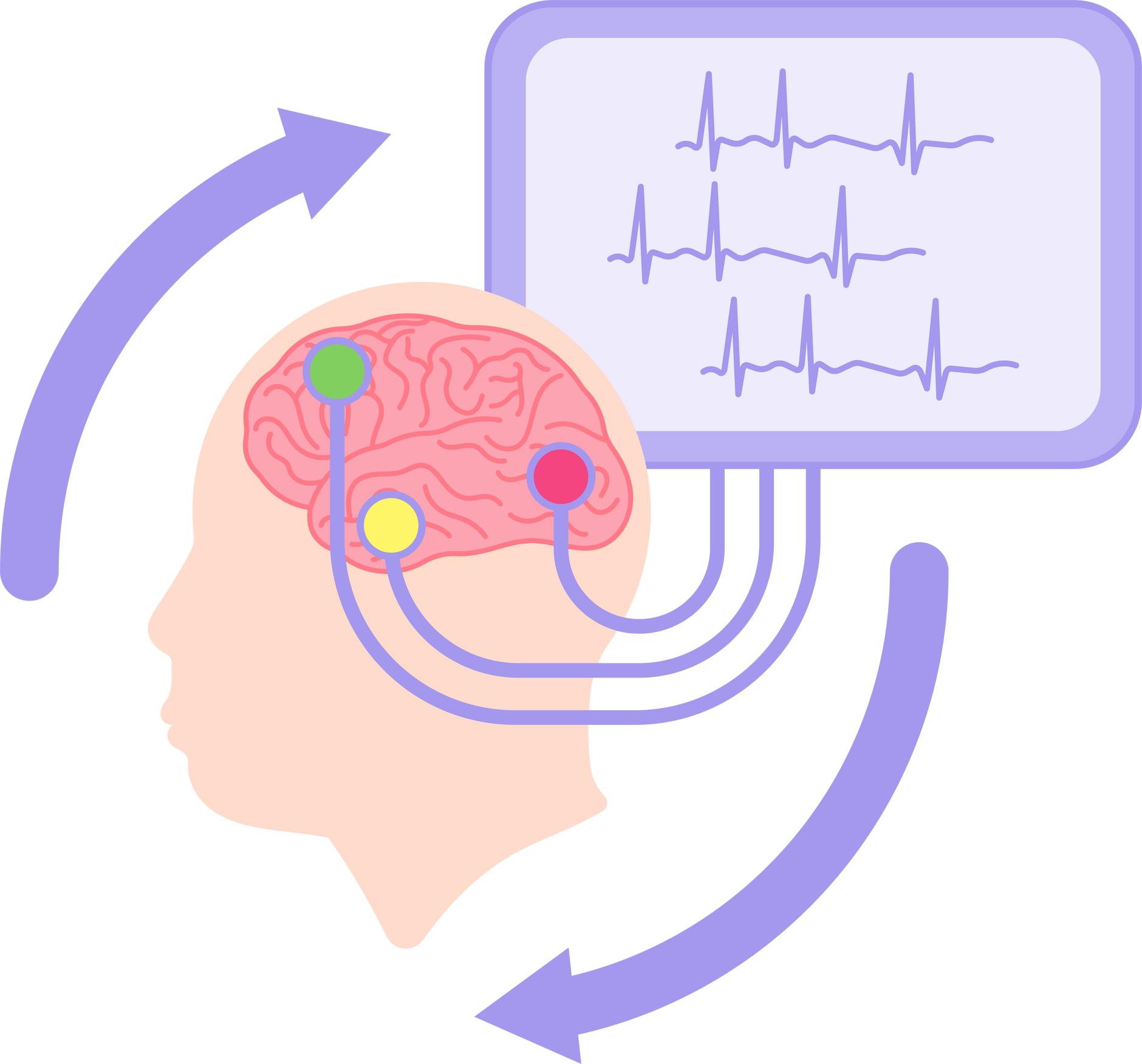 emg and ncv nerve autism brain conduction study EEG floor stress Post Traumatic PTSD anxiety ADHD TMS Transcranial Magnetic Stimulation